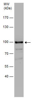 Western blot - Anti-MACC1 antibody (AB226803)