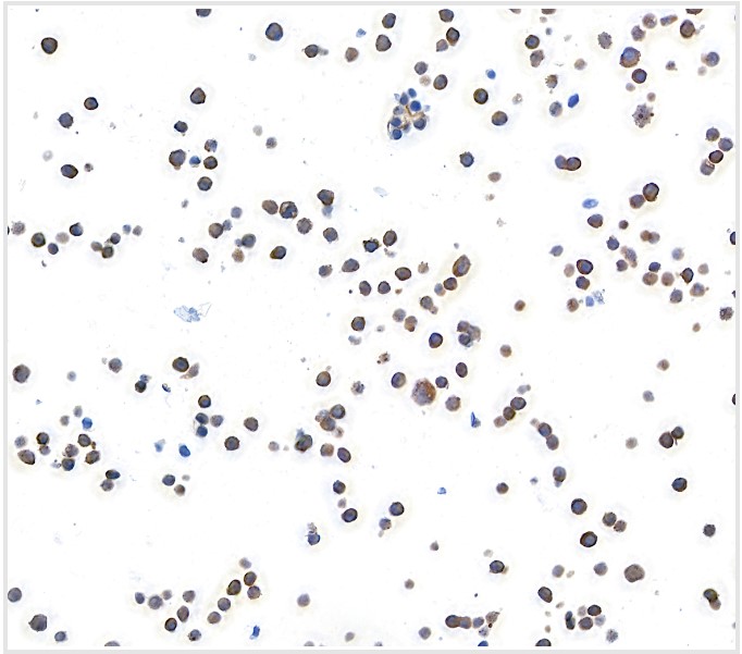 Immunocytochemistry - Anti-MACC1 antibody [BLR135H] - BSA free (AB314047), expandable thumbnail