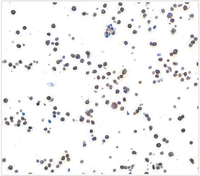 Immunocytochemistry - Anti-MACC1 antibody [BLR135H] - BSA free (AB314047)