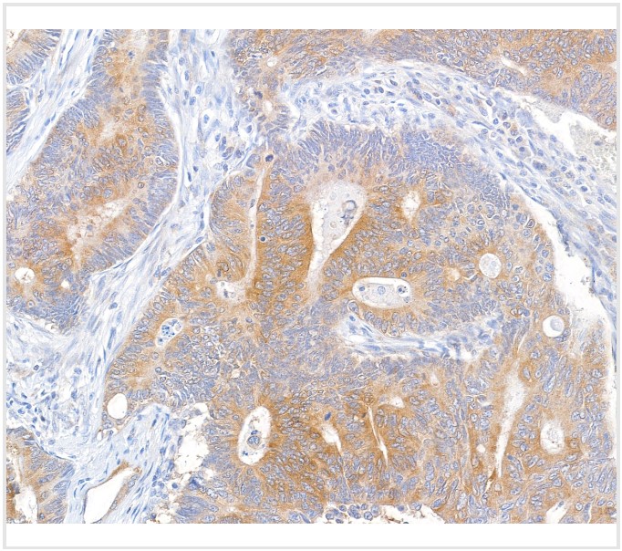 Immunohistochemistry (Formalin/PFA-fixed paraffin-embedded sections) - Anti-MACC1 antibody [BLR135H] - BSA free (AB314047), expandable thumbnail