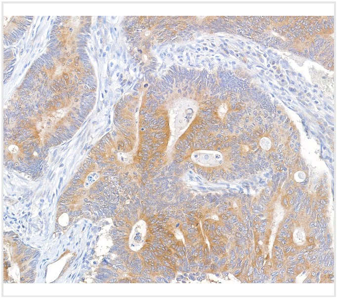 Immunohistochemistry (Formalin/PFA-fixed paraffin-embedded sections) - Anti-MACC1 antibody [BLR135H] - BSA free (AB314047)