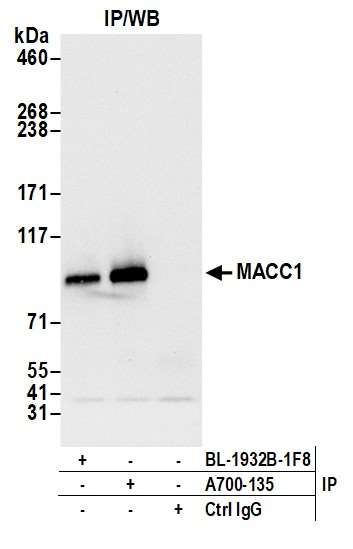 Immunoprecipitation - Anti-MACC1 antibody [BLR135H] - BSA free (AB314047), expandable thumbnail