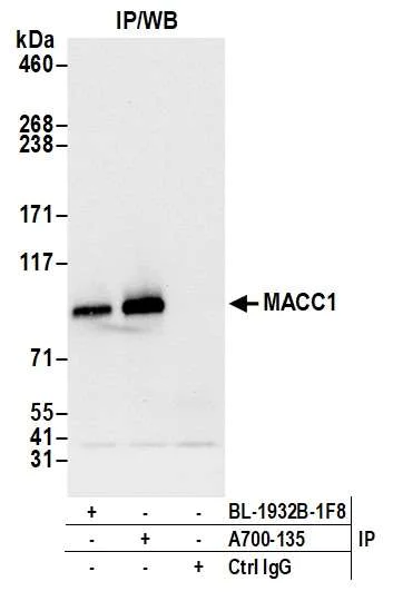 Immunoprecipitation - Anti-MACC1 antibody [BLR135H] - BSA free (AB314047)