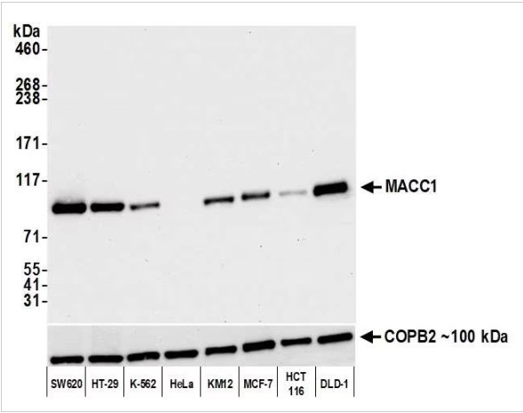 Western blot - Anti-MACC1 antibody [BLR135H] - BSA free (AB314047), expandable thumbnail