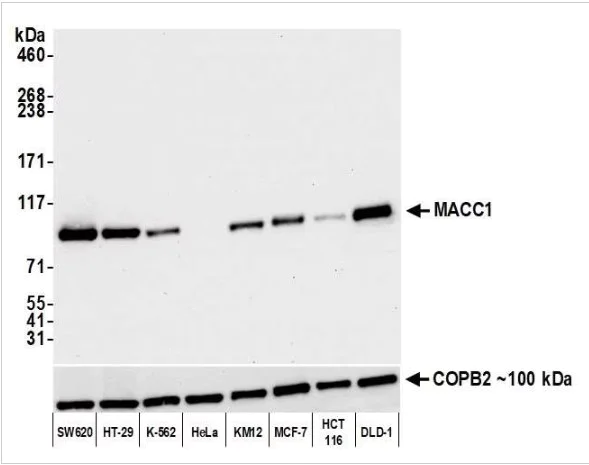 Western blot - Anti-MACC1 antibody [BLR135H] - BSA free (AB314047)