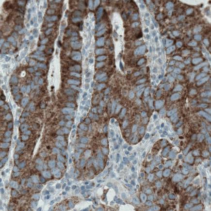 Immunohistochemistry (Formalin/PFA-fixed paraffin-embedded sections) - Anti-MACC1 antibody [CL0856] (ab242199), expandable thumbnail