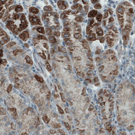Immunohistochemistry (Formalin/PFA-fixed paraffin-embedded sections) - Anti-MACC1 antibody [CL0856] (AB242199), expandable thumbnail