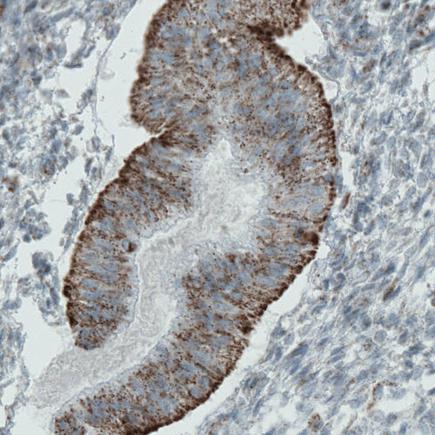 Immunohistochemistry (Formalin/PFA-fixed paraffin-embedded sections) - Anti-MACC1 antibody [CL0856] (AB242199), expandable thumbnail