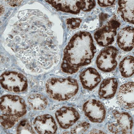 Immunohistochemistry (Formalin/PFA-fixed paraffin-embedded sections) - Anti-MACC1 antibody [CL0856] (AB242199), expandable thumbnail