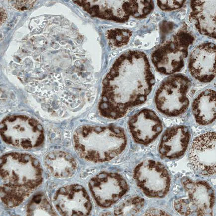 Immunohistochemistry (Formalin/PFA-fixed paraffin-embedded sections) - Anti-MACC1 antibody [CL0856] (AB242199)