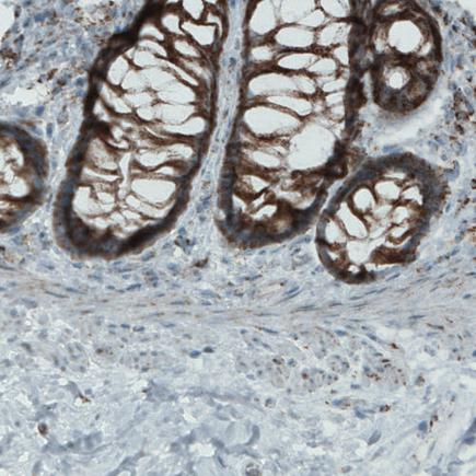 Immunohistochemistry (Formalin/PFA-fixed paraffin-embedded sections) - Anti-MACC1 antibody [CL0856] (ab242199), expandable thumbnail