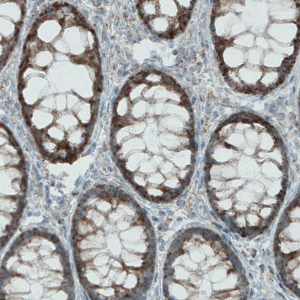 Immunohistochemistry (Formalin/PFA-fixed paraffin-embedded sections) - Anti-MACC1 antibody [CL0856] (AB242199), expandable thumbnail