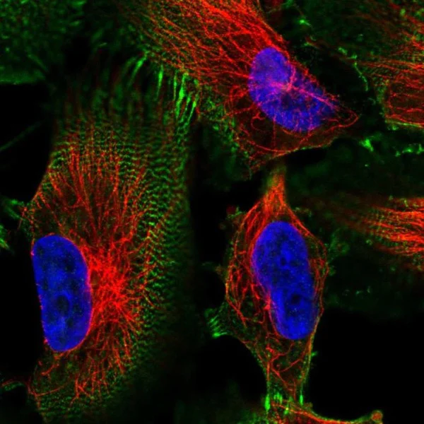 Immunocytochemistry/ Immunofluorescence - Anti-MACF1 antibody (AB221989)
