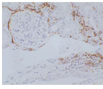Immunohistochemistry (Formalin/PFA-fixed paraffin-embedded sections) - Anti-Macrophage antibody [RM0029-11H3] (AB56297)