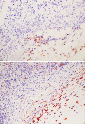 Immunohistochemistry (Formalin/PFA-fixed paraffin-embedded sections) - Anti-Macrophage antibody [RM0029-11H3] (AB56297)