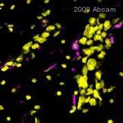 Immunohistochemistry (Formalin/PFA-fixed paraffin-embedded sections) - Anti-Macrophage antibody [RM0029-11H3] (AB56297)