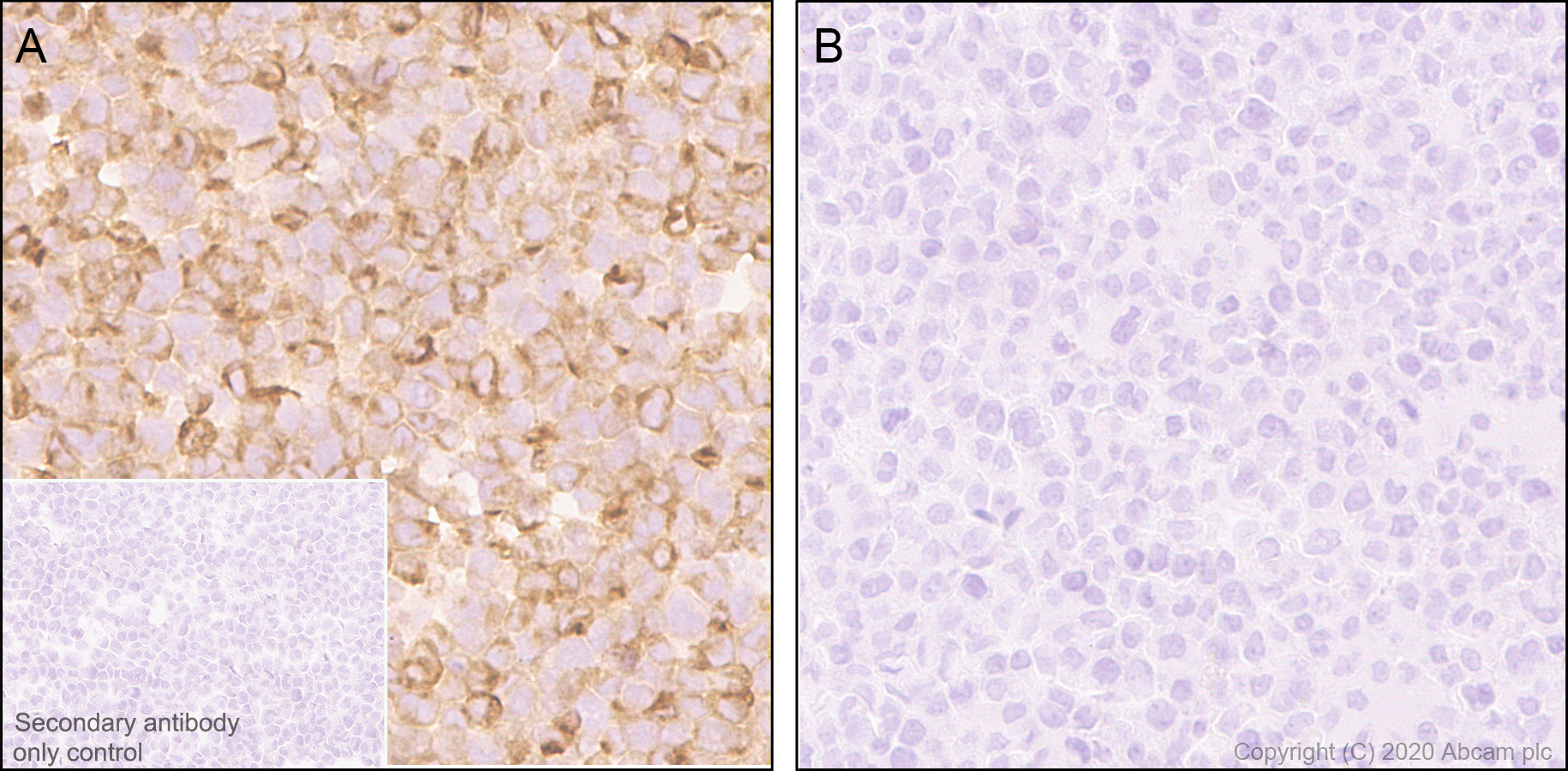 Immunohistochemistry (Formalin/PFA-fixed paraffin-embedded sections) - Anti-Macrophage Inflammatory Protein 1 alpha / CCL3 + CCL3L1 antibody [EPR23751-54] (ab259372), expandable thumbnail