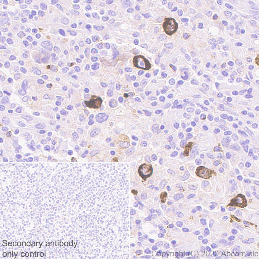 Immunohistochemistry (Formalin/PFA-fixed paraffin-embedded sections) - Anti-Macrophage Inflammatory Protein 1 alpha / CCL3 + CCL3L1 antibody [EPR23751-54] (AB259372), expandable thumbnail