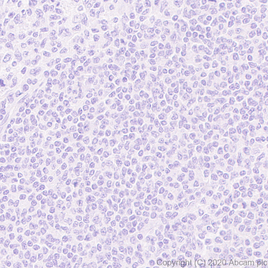 Immunohistochemistry (Formalin/PFA-fixed paraffin-embedded sections) - Anti-Macrophage Inflammatory Protein 1 alpha / CCL3 + CCL3L1 antibody [EPR23751-54] (ab259372), expandable thumbnail