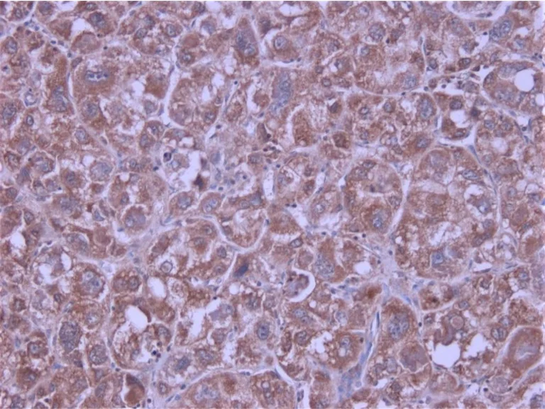 Immunohistochemistry (Formalin/PFA-fixed paraffin-embedded sections) - Anti-Macrophage Inflammatory Protein 3 alpha antibody (AB9829)