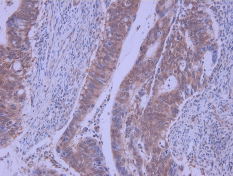 Immunohistochemistry (Formalin/PFA-fixed paraffin-embedded sections) - Anti-Macrophage Inflammatory Protein 3 alpha antibody (AB9829), expandable thumbnail