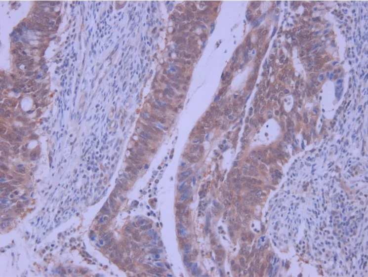 Immunohistochemistry (Formalin/PFA-fixed paraffin-embedded sections) - Anti-Macrophage Inflammatory Protein 3 alpha antibody (AB9829)