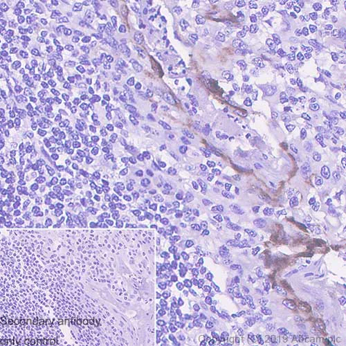 Immunohistochemistry (Formalin/PFA-fixed paraffin-embedded sections) - Anti-Macrophage Inflammatory Protein 3 alpha antibody [EPR22376-58] - BSA and Azide free (AB261730)