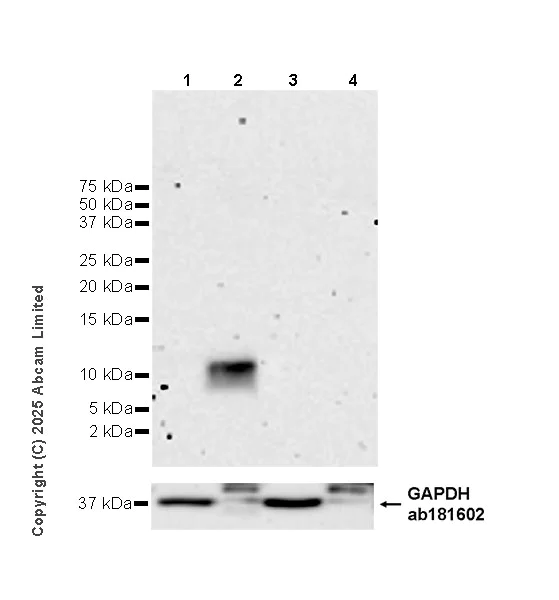 Western blot - Anti-Macrophage Inflammatory Protein 3 alpha/CCL-20 antibody [EPR29900-73] (AB325496)