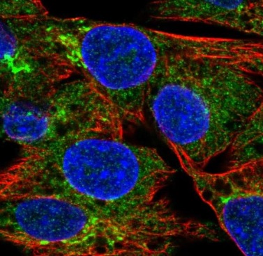 Immunocytochemistry/ Immunofluorescence - Anti-Macrophage inflammatory protein 5 antibody (AB221040)
