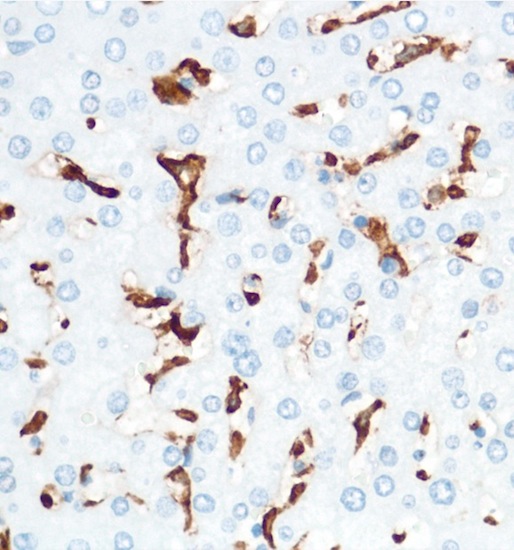 Immunohistochemistry (Formalin/PFA-fixed paraffin-embedded sections) - Macrophage Marker (CD11b, CD68, CD163, CD14, CD16) Antibody Panel - Human (AB254013), expandable thumbnail