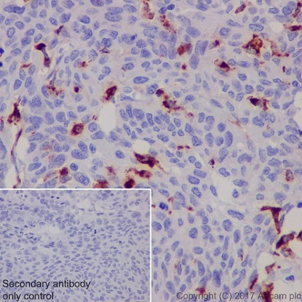Immunohistochemistry (Formalin/PFA-fixed paraffin-embedded sections) - Macrophage Marker (CD11b, CD68, CD163, CD14, CD16) Antibody Panel - Human (AB254013), expandable thumbnail