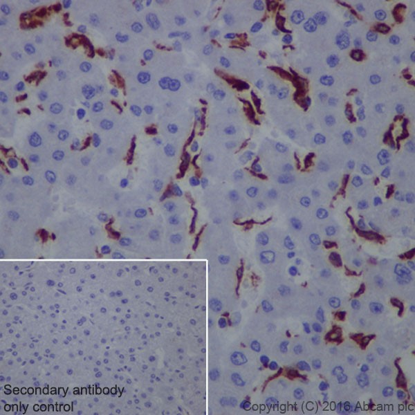 Immunohistochemistry (Formalin/PFA-fixed paraffin-embedded sections) - Macrophage Marker (CD11b, CD68, CD163, CD14, CD16) Antibody Panel - Human (AB254013), expandable thumbnail