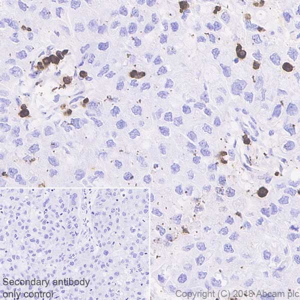 Immunohistochemistry (Formalin/PFA-fixed paraffin-embedded sections) - Macrophage Marker (CD11b, CD68, CD163, CD14, CD16) Antibody Panel - Human (AB254013), expandable thumbnail