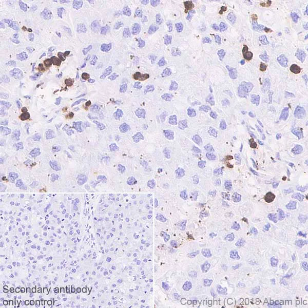 macrophage様ご確認用出品 Macrophage Marker Antibody Panel - Human (ab254013) | Abcam