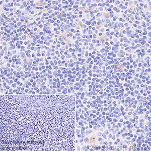 Immunohistochemistry (Formalin/PFA-fixed paraffin-embedded sections) - Macrophage Polarization Panel - Human IHC (AB278180)