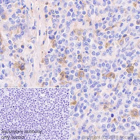 Immunohistochemistry (Formalin/PFA-fixed paraffin-embedded sections) - Macrophage Polarization Panel - Human IHC (AB278180)