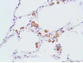 Immunohistochemistry (Formalin/PFA-fixed paraffin-embedded sections) - Macrophage Polarization Panel - Human IHC (AB278180)