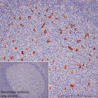 Immunohistochemistry (Formalin/PFA-fixed paraffin-embedded sections) - Macrophage Polarization Panel - Human IHC (AB278180)