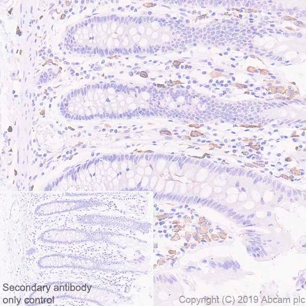Immunohistochemistry (Formalin/PFA-fixed paraffin-embedded sections) - Macrophage Polarization Panel - Human IHC (AB278180)