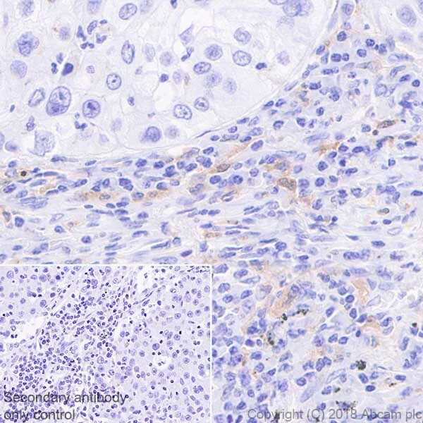 Immunohistochemistry (Formalin/PFA-fixed paraffin-embedded sections) - Macrophage Polarization Panel - Human IHC (AB278180)