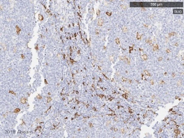 Immunohistochemistry (Formalin/PFA-fixed paraffin-embedded sections) - Macrophage Polarization Panel - Human IHC (AB278180)