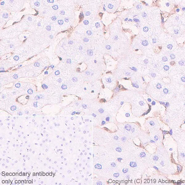 Immunohistochemistry (Formalin/PFA-fixed paraffin-embedded sections) - Macrophage Polarization Panel - Human IHC (AB278180)