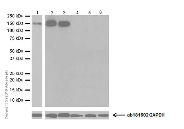 Western blot - Macrophage Polarization Panel - Human WB (AB278181)