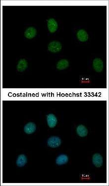 Immunocytochemistry/ Immunofluorescence - Anti-MAD1L1/MAD1 antibody (AB126148), expandable thumbnail