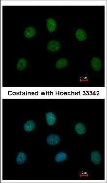 Immunocytochemistry/ Immunofluorescence - Anti-MAD1L1/MAD1 antibody (AB126148)