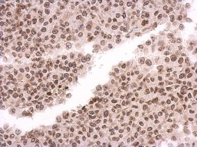 Immunohistochemistry (Formalin/PFA-fixed paraffin-embedded sections) - Anti-MAD1L1/MAD1 antibody (AB126148), expandable thumbnail
