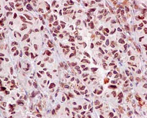 Immunohistochemistry (Formalin/PFA-fixed paraffin-embedded sections) - Anti-MAD1L1/MAD1 antibody [EPR14676-23] - BSA and Azide free (AB250761)