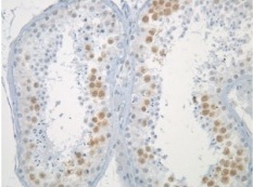 Immunohistochemistry (Formalin/PFA-fixed paraffin-embedded sections) - Anti-Mad2L1 antibody [17D10] (AB10691)