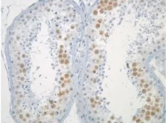 Immunohistochemistry (Formalin/PFA-fixed paraffin-embedded sections) - Anti-Mad2L1 antibody [17D10] (AB10691)