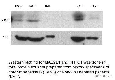 Western blot - Anti-Mad2L1 antibody [17D10] (AB10691)